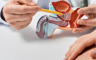 Descarte de Cáncer de Próstata (menores de 40 años)