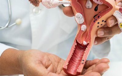 Descarte de Cáncer de cuello uterino